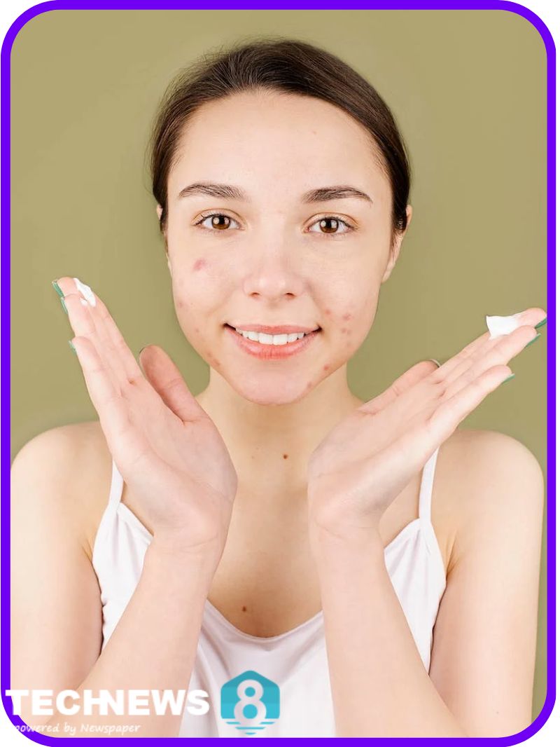 How to use toothpaste for acne safely Thich Thi Chieu
